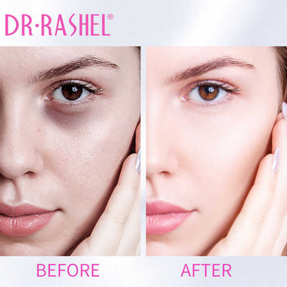   Dr.Rashel Whitening Cleansing Mousse - 115ml